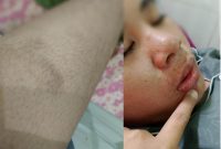 Foto: Korban pengeroyokan 