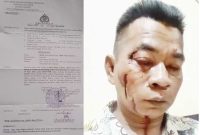 Foto: Moh Ali Hasan, korban dugaan pengeroyokan yang dilakukan anak dan orang tua di dusun Taroh, Kecamatan Ambunten 