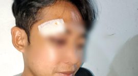 Foto : Korban pengeroyokan brutal 