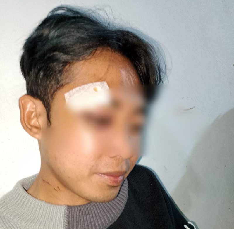 Foto : Korban pengeroyokan brutal 