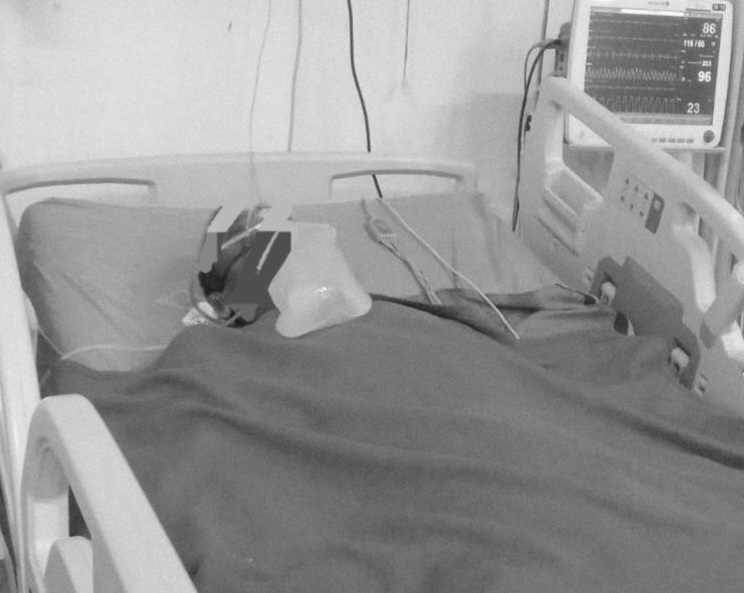 Ket foto: Pasien saat menjalani perawatan intensif di ruang ICU RSUD Sumenep